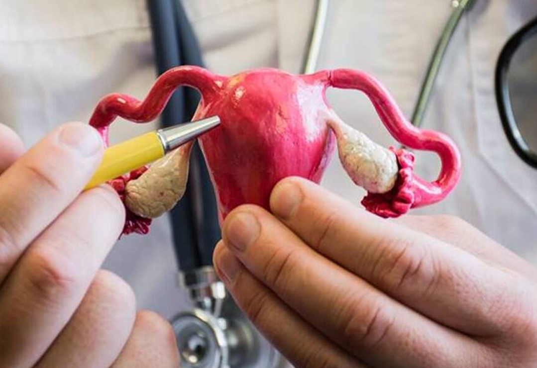 Fibroids Treatment