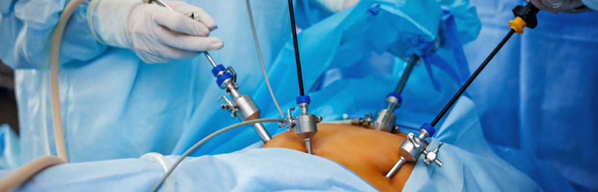 Laparoscopic Surgery